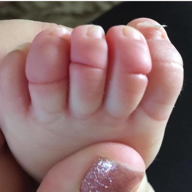 濡堝鍙戠幇瀛╁瓙鍏牴鑴氳毒,濡堝鑴氳毒鎴偄