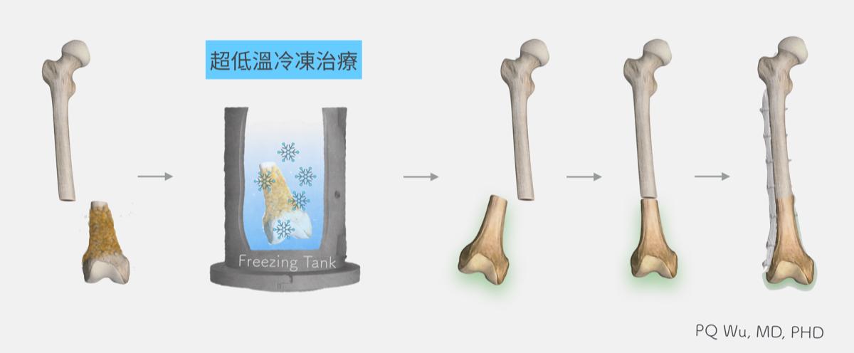 注射一针疫苗，就能杀死身上所有癌细胞，这种理想离实现有多远？