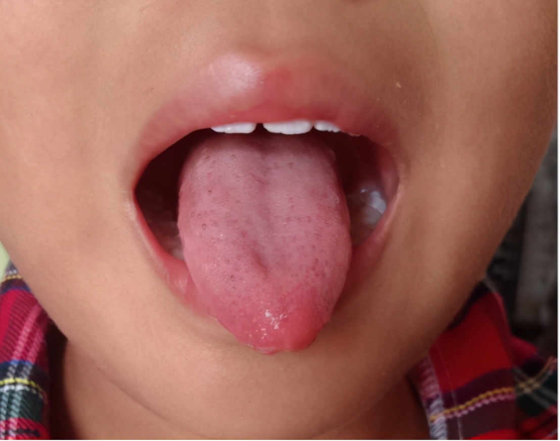 孩子盗汗脾胃虚弱怎么调理,湿热气虚自汗盗汗怎么调理