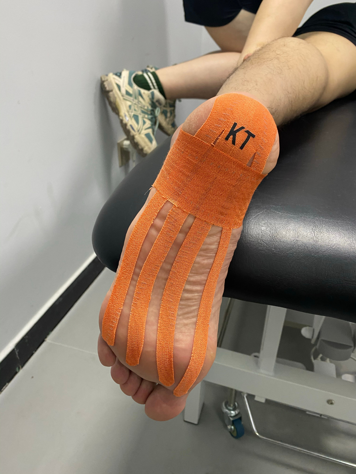 郭艾伦足底康复,郭艾伦什么病需要干细胞治疗