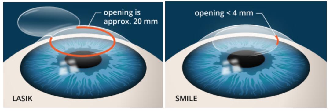 近视这么多为啥近视行业不好做,行业近视症会导致企业迅速衰败吗