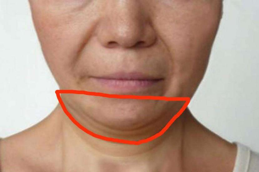 剖腹产5年了还能顺产吗,五年剖腹产三次危险吗