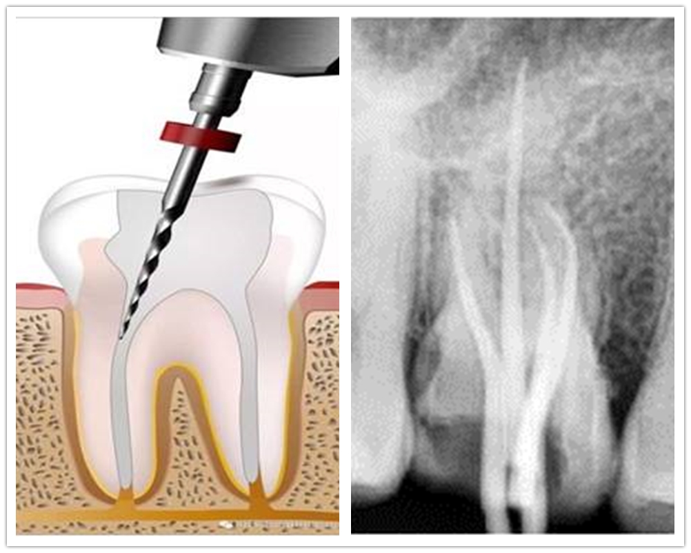 口腔科诊疗指南及技术操作常规,口腔科疾病的最新诊疗护理措施