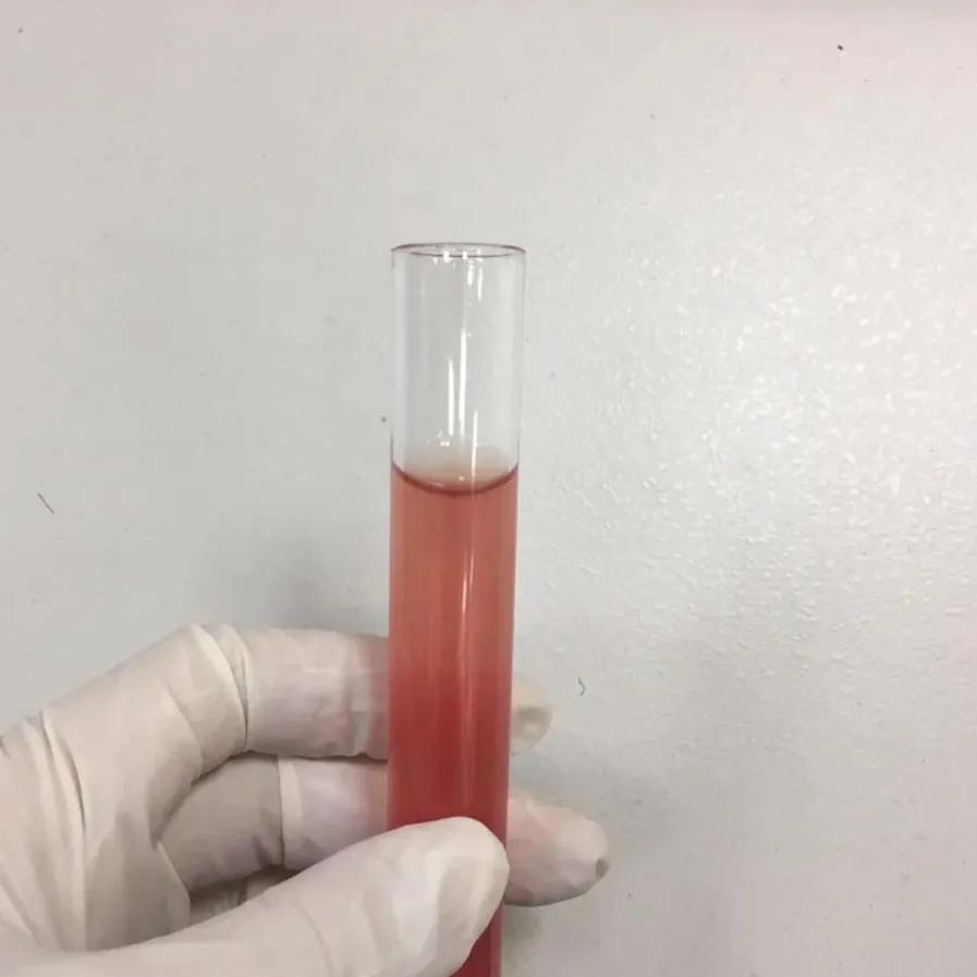 男性小便尿血怎么回事,80岁男性尿血怎么办