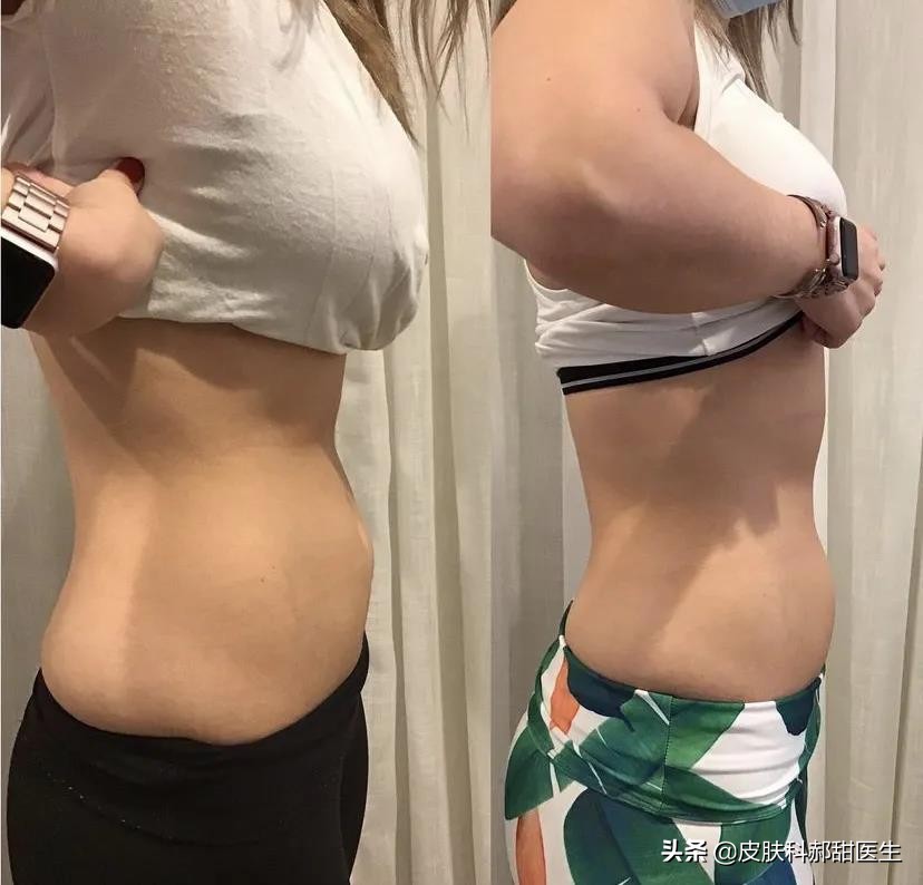 漾格医美皮秒怎么样,漾格医美场景视频