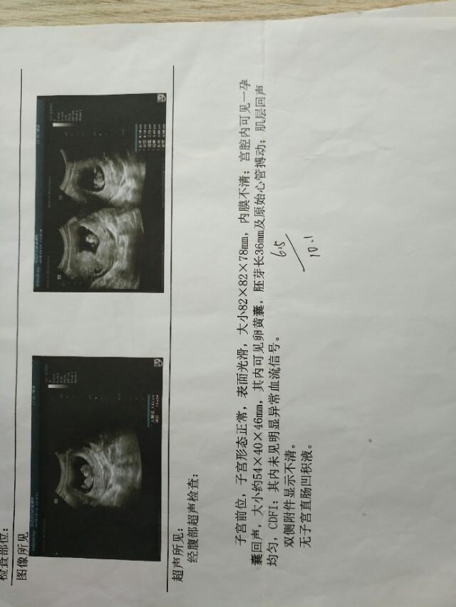 孕期产检全流程一次性说清楚了,孕期检查全流程