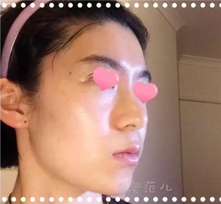 贵的面膜都有塑料纸吗,贵的面膜