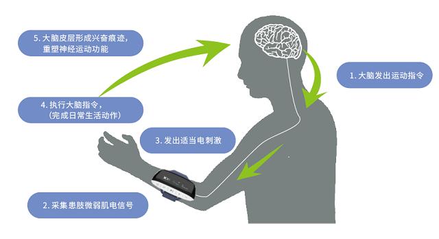 讯丰通偏瘫助行仪,讯丰通第二代手功能康复仪