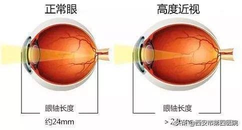健康科普汇什么是儿童晕厥,健康科普眼球