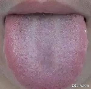 舌头反映了身体的哪些器官,舌头出现信号对身体有什么危险