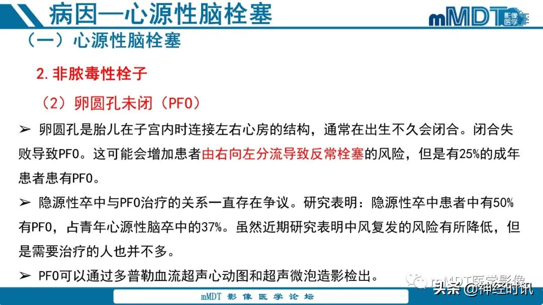 急性缺血性脑卒中ppt素材图片,青年缺血性脑卒中ppt