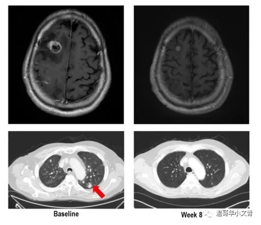 可以让人兴奋的药品,最新治疗甲状腺癌新药