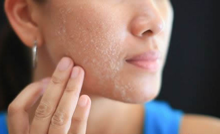 脸上过敏发红发痒肿怎么办最有效,脸上过敏发红还肿怎么办