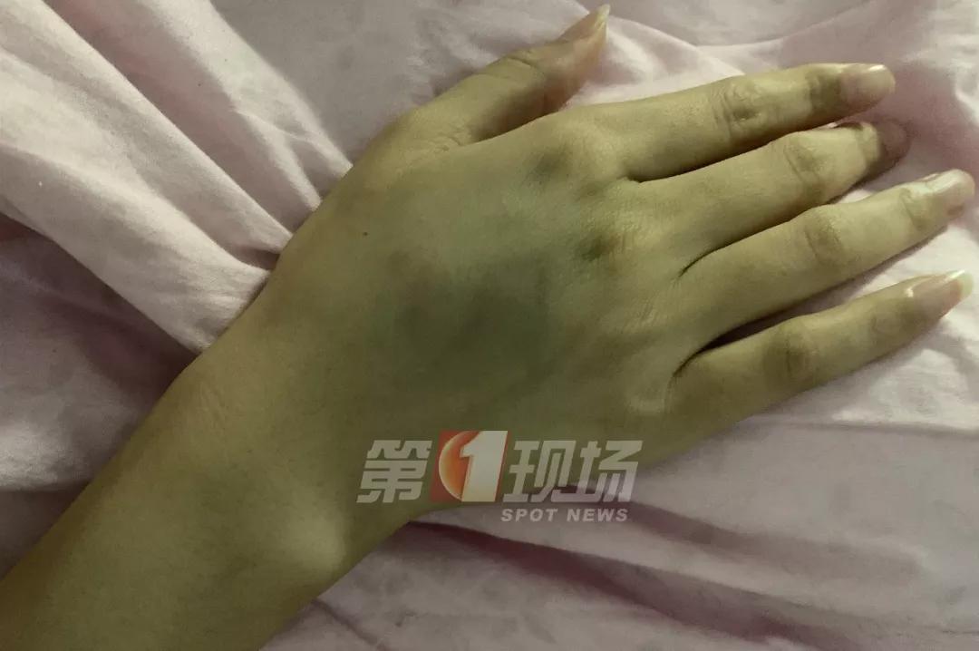 男子因快递未送达遭投诉上门暴打,女子投诉遭快递员暴打