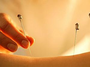 神经根型颈椎病保守治疗效果好吗,神经根型颈椎病保守治疗效果