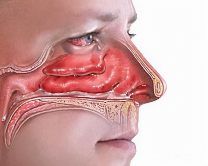 一般性头痛看什么科室,不明头痛是怎么回事