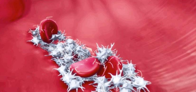 血小板破裂是什么意思,血小板凝固原因