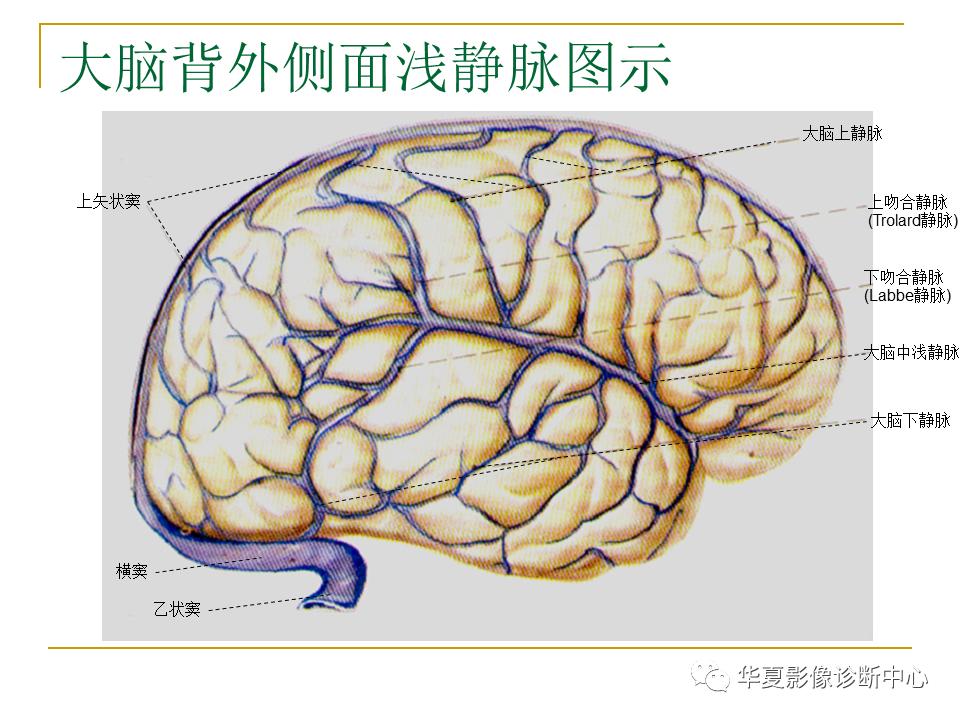 中国人脑立体定向mri应用解剖图谱,脑mri示意图