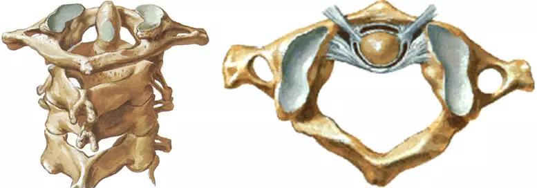 颈椎腰椎疾病ct及mri诊断,腰椎ct可以发现肠部病变吗