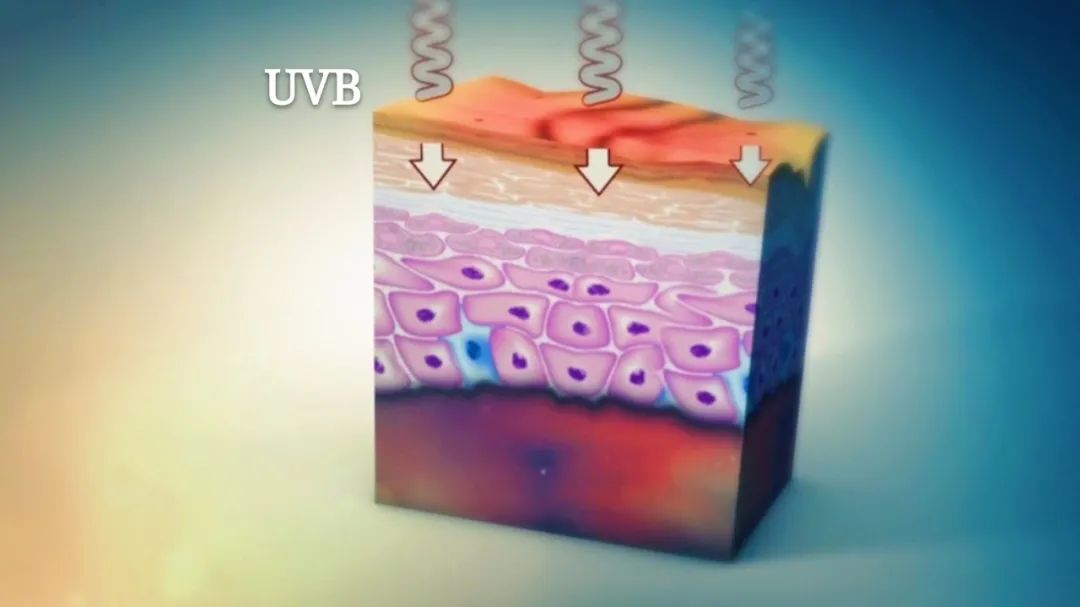 不闷痘清爽适合油皮的防晒,阴天不用涂防晒