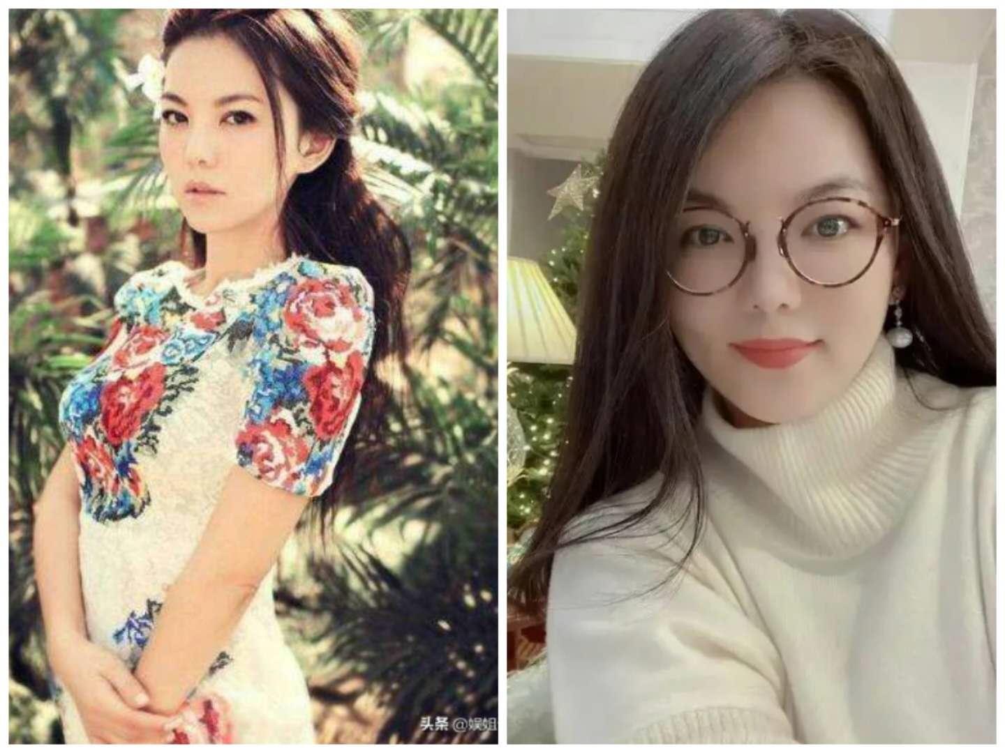 79岁英国一富婆为“除皱”，连打30年玻尿酸抗老，如今长啥样了？