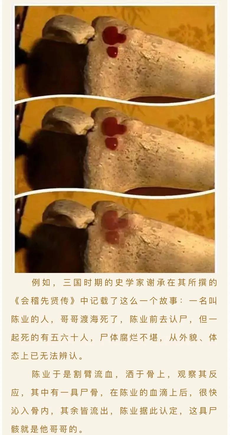 亲子鉴定那些事儿,亲子鉴定的那些事儿