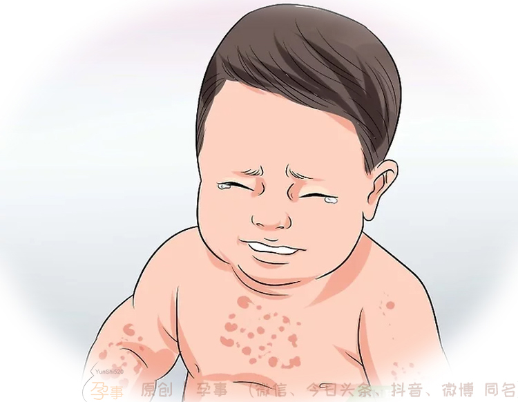 宝宝夏天起痱子最有效的解决方法,宝宝长了痱子用什么方法最有效
