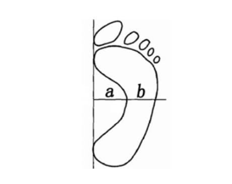 扁平足穿鞋子容易变形怎么改善,扁平足对日常有什么影响