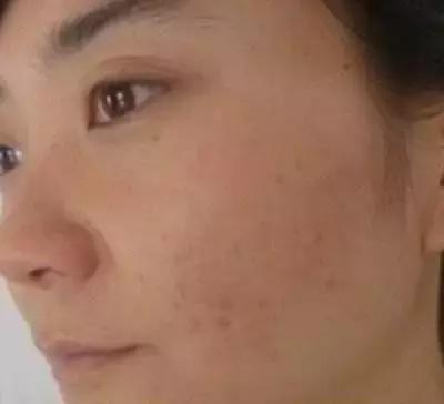 日本这个赛过美白针的王牌内服，让贵妇POLA、SK-II靠边站！