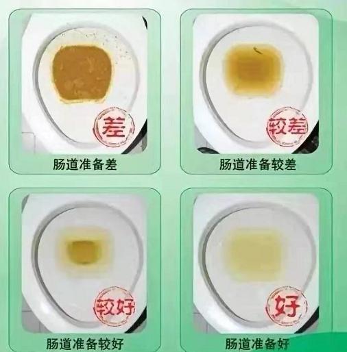 科普肠镜,科普医疗带来恐惧