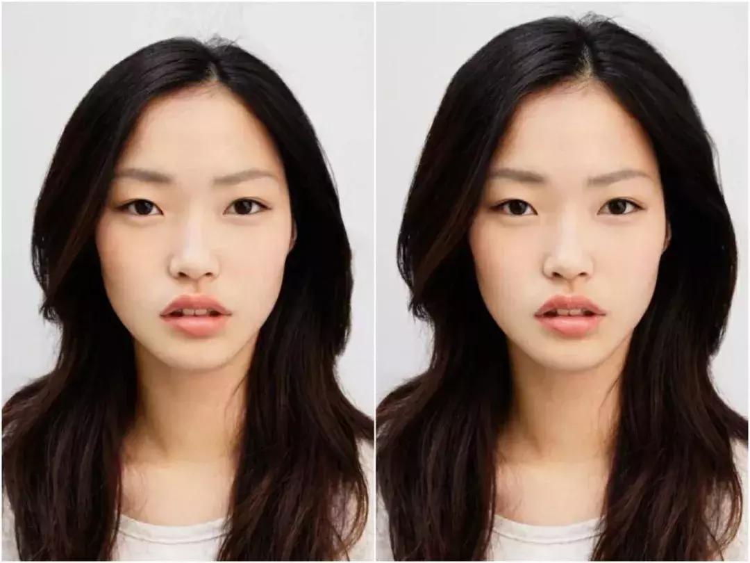 头发毛躁并且脱发推荐洗发水,用什么洗发水改善头皮脱发