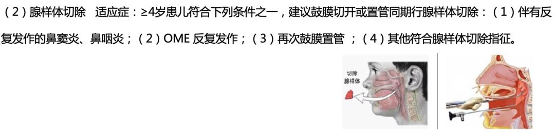 WASS峰会｜针对病因有效治疗，可改善部分儿童的听力损失