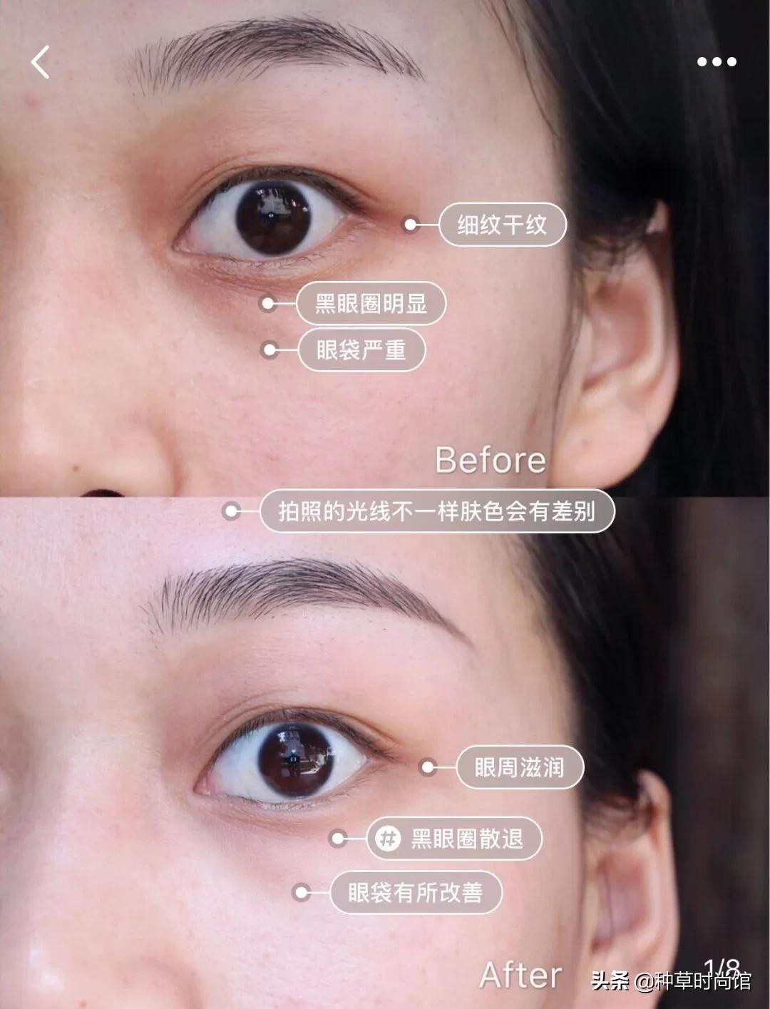 浣犵殑鐪奸湝鏄孩姒滃悧,浣犵殑鐪艰啘鏄笉鏄创閿欎簡