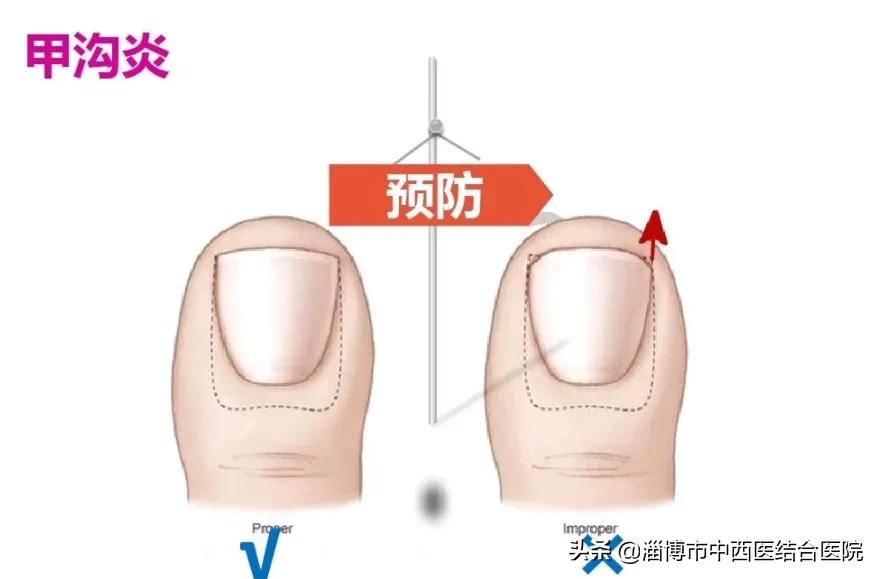 中西结合治疗好疾病,中西结合预防疾病