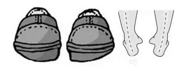 走路磨鞋底怎么办,走路总是磨鞋内侧什么原因