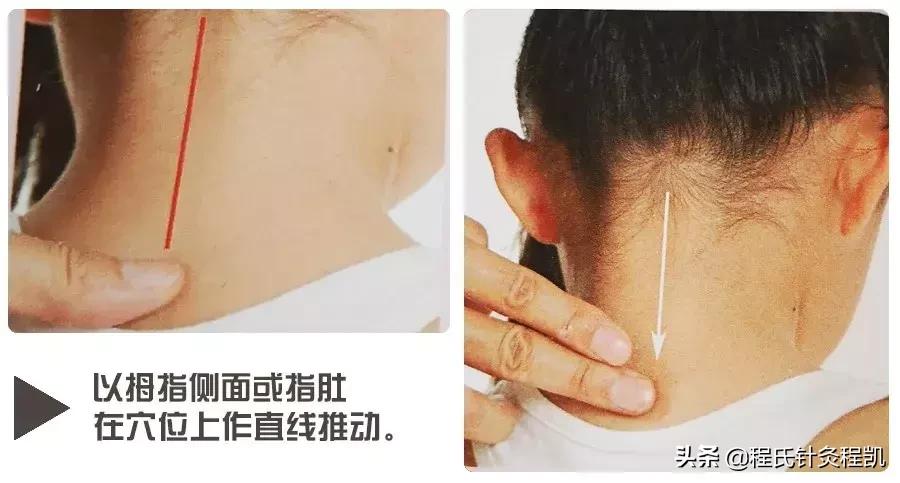 脾胃不和长期咳嗽的小儿推拿视频,小儿推拿流鼻涕咳嗽推哪个穴位