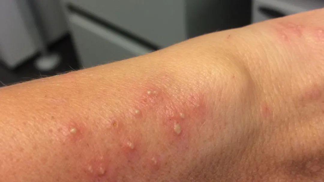 红火蚁一般生存在哪些地方呢,红火蚁可以在哪里生存