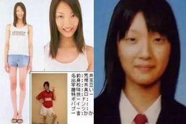 日本整容真的很好吗,日本整容vs韩国整容图片对比