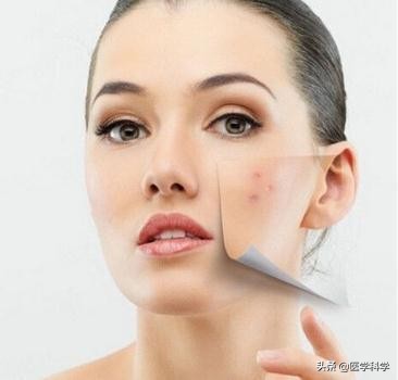 如何防止脸上长痘痘,为什么脸上老是长痘痘