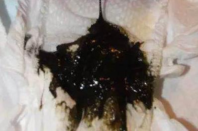 刚出生的宝宝特殊现象,刚出生宝宝吓住了怎么办