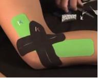 髂胫束摩擦综合征（膝外侧疼痛）跑步杀手，自我预防、康复的方法