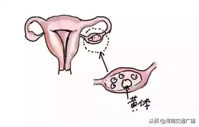 女人卵巢破裂的真实案例,卵巢发生破裂