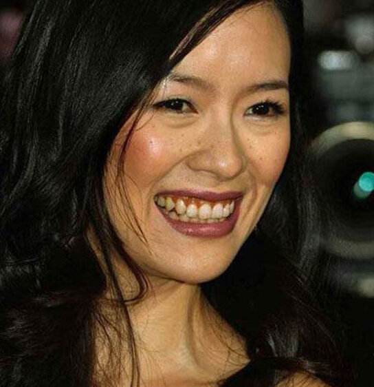 牙黄口臭怎么办用什么牙膏,黄牙口臭解决方法牙膏