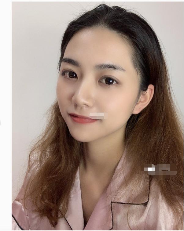 买对不卖贵,有钱也不人性!皮肤科护士的私藏祛痘用品分享