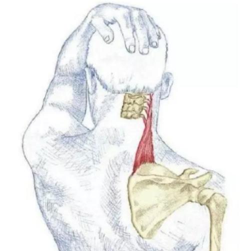 溜肩，长得再瘦体型也垮垮的。但溜肩常见这两种情况，别练错