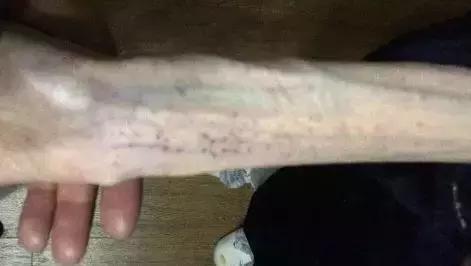 21岁少女“自杀式”减肥，智商税到底还要交多少？