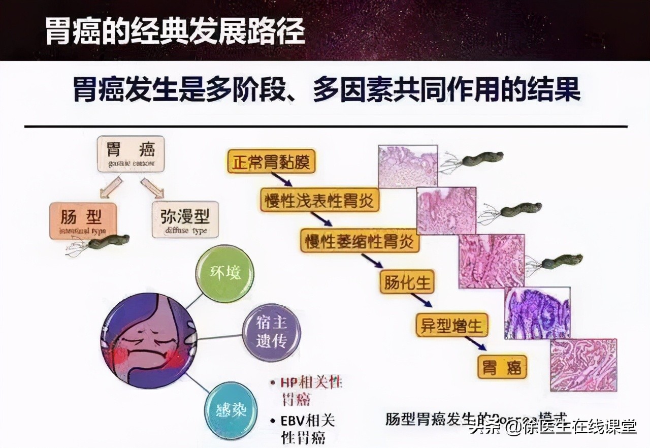 从炎症到癌症，一般需要多长时间？医生：3种炎症，尽量不要拖