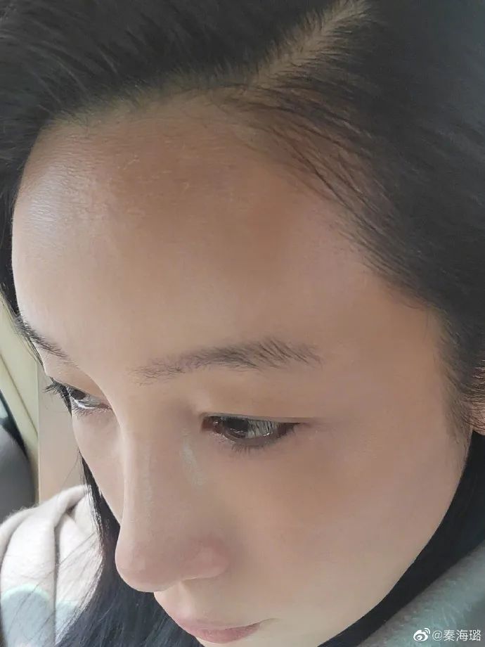 秦海璐紧致皮肤,秦海璐美白皮肤