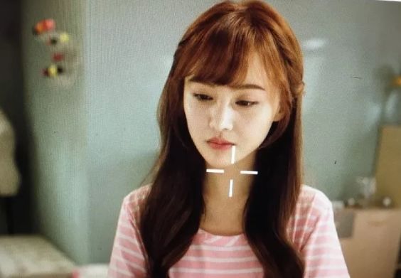 发际线秃有没有好的方法,发际线秃了一块怎么弄齐刘海