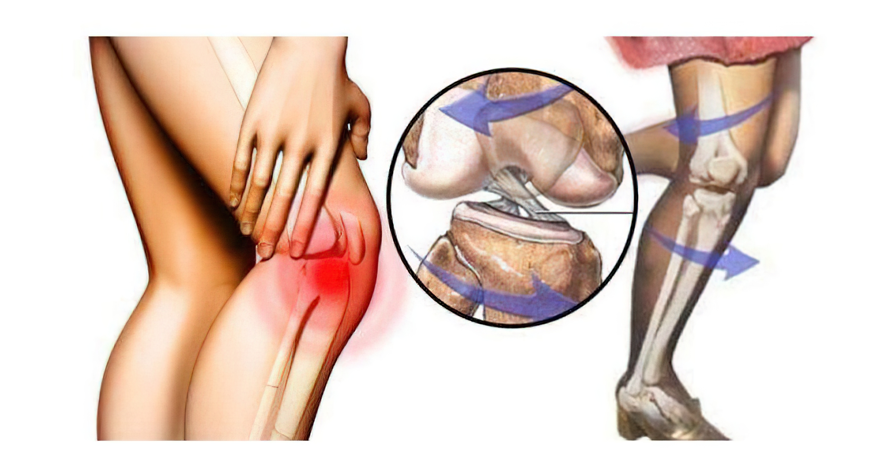 卢老太治骨病,膝盖骨刺和增生打针和理疗哪个好